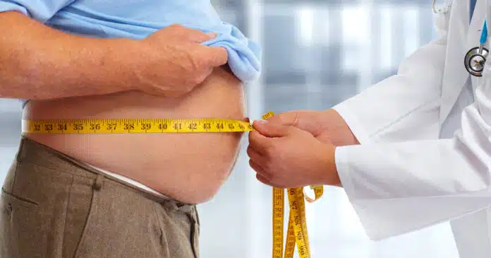 Covid: aumento di peso nel 48% dei pazienti obesi
