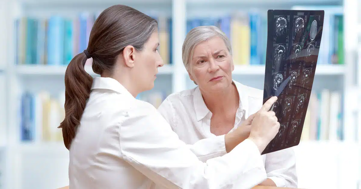 Insonnia e aneurisma cerebrale lo studio della relazione