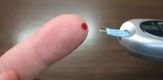 diabete e malattia di alzheimer