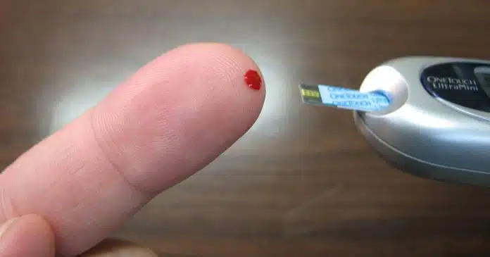 diabete e malattia di alzheimer