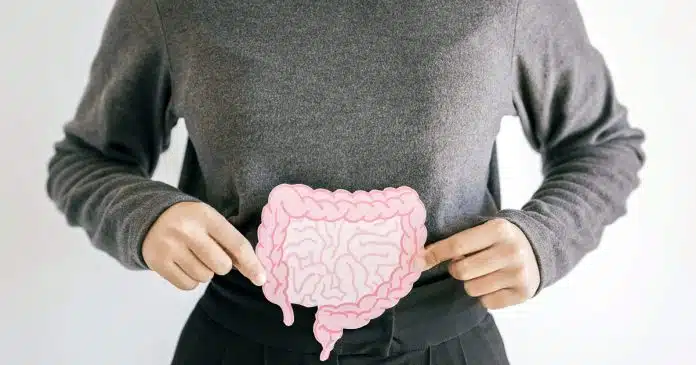 prevenzione tumori colon retto